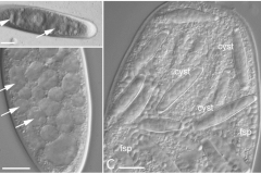 Metchnikovella incurvata, a parasite of bristle worm infecting gregarine. Picture from Galindo et al. 2018, https://doi.org/10.1093/gbe/evy205