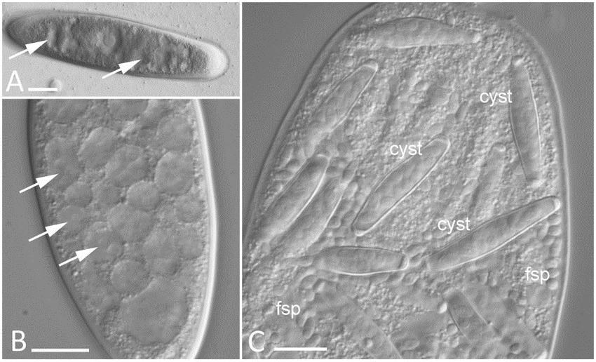 Metchnikovella incurvata, a parasite of bristle worm infecting gregarine. Picture from Galindo et al. 2018, https://doi.org/10.1093/gbe/evy205